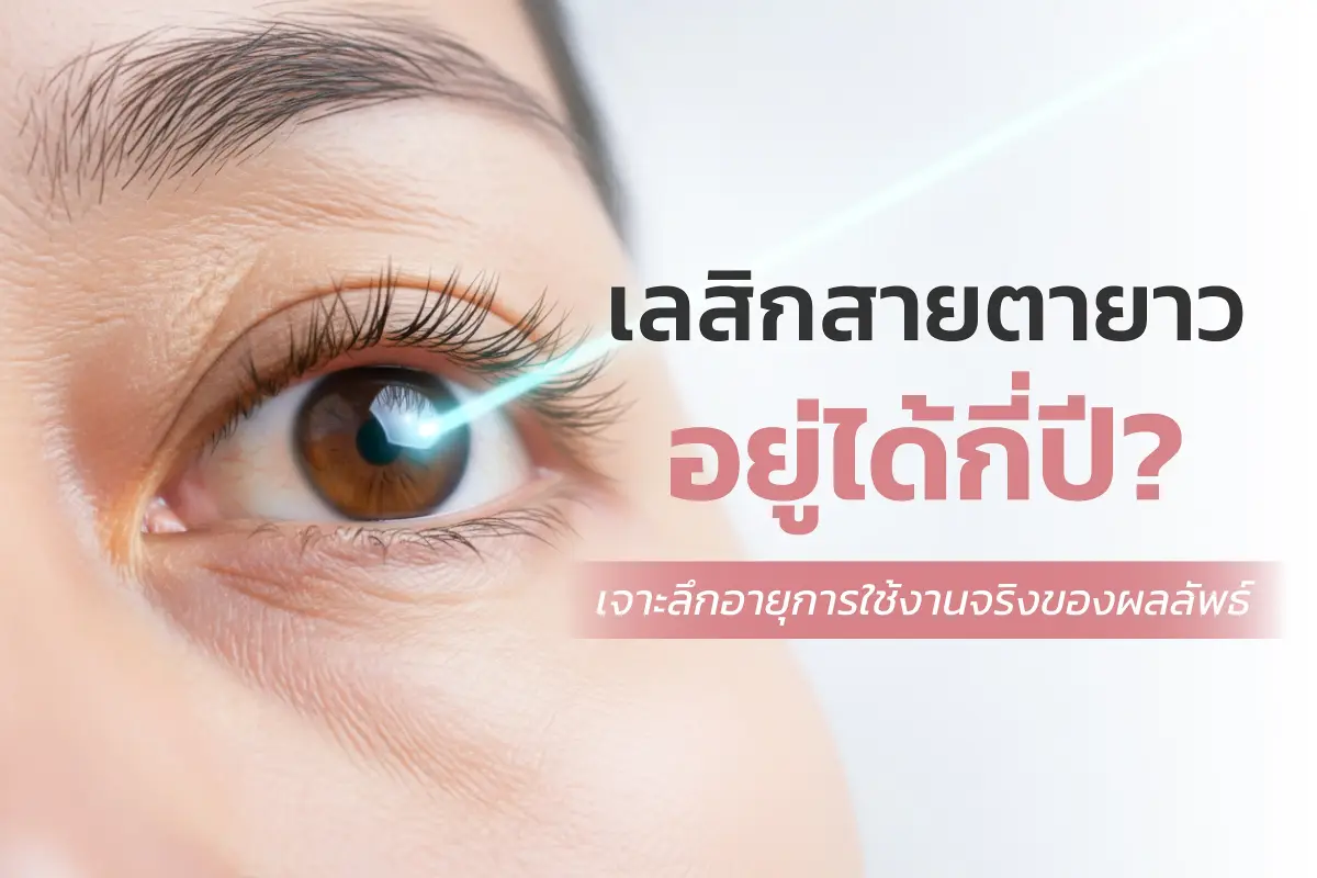  เลสิกสายตายาวอยู่ได้กี่ปี? เจาะลึกอายุการใช้งานจริงของผลลัพธ์